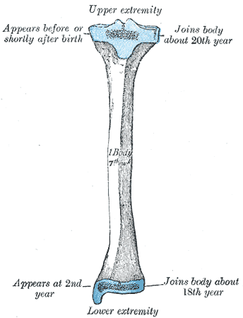 image:Gray260.png