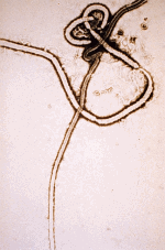 ebola_virus_em.png