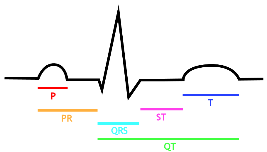 Drawing of the EKG, with labels of intervalsP=P wave, PR=PR segment, QRS=QRS complex, QT=QT interval, ST=ST segment, T=T wave.