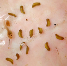 Embryos (and one ) of the wrinkled frog (Rana rugosa).
