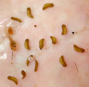 Embryos (and one tadpole) of the wrinkled frog (Rana rugosa)