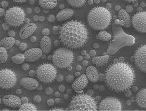  image of pollen grains from a variety of common plants: sunflower (), morning glory (),hollyhock (), lily (), primrose(), and castor bean (). 