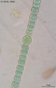 Anabaena sperica - Heterocysts form enlarged cells