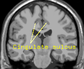  showing the cingulate sulcus in a .