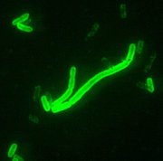 Yersinia pestis under fluorescent staining, 2000x. Source: CDC