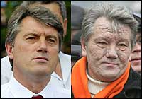 Viktor Yushchenko as he appeared in July 2004 (left) and as he appeared in November 2004 (right) after dioxin poisoning